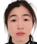 Song Fei